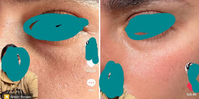 Sunday riley eye serum